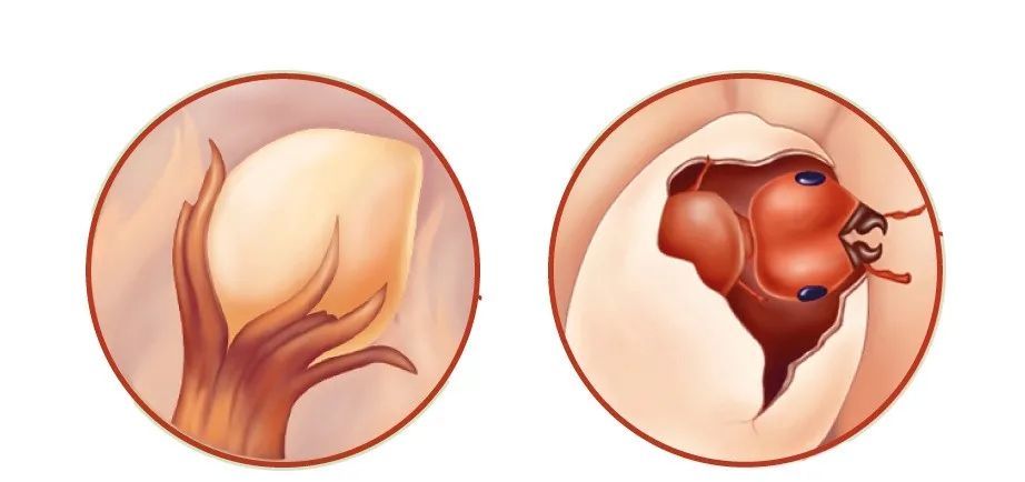 榕小蜂|从青梅竹马，到两个物种、四位家长共同组建的家庭