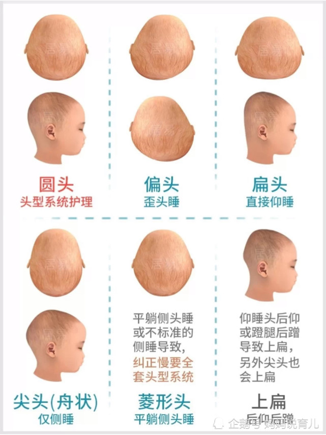 宝宝头型很扁怎么办 跟着宝妈这样做 让宝宝拥有赵丽颖同款圆头 腾讯网