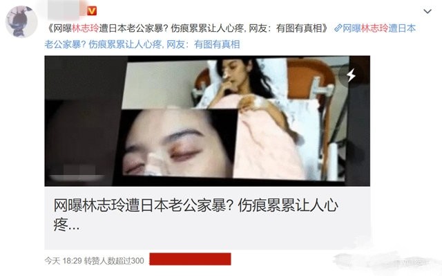 林志玲|不能生育遭日本老公家暴离婚？林志玲发文否认，七夕晒照秀恩爱