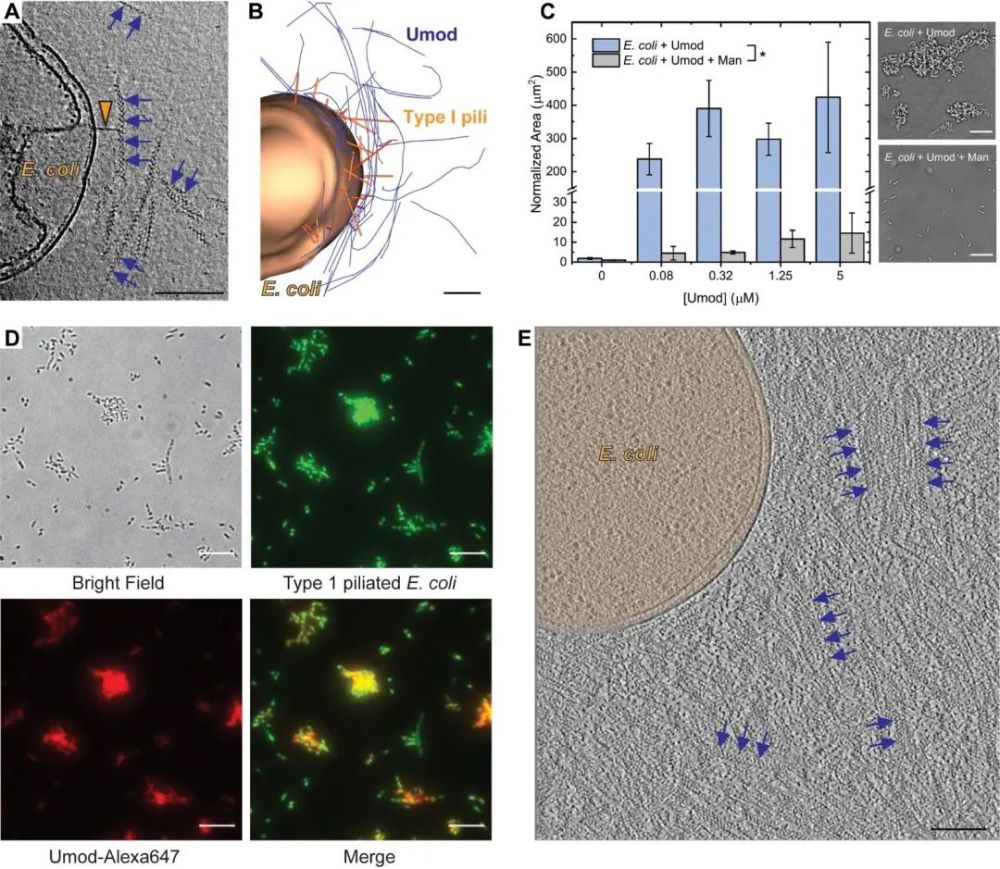 随后,研究人员通过cryoet成像分析了umod细丝与Ⅰ型有毛和无毛型大肠