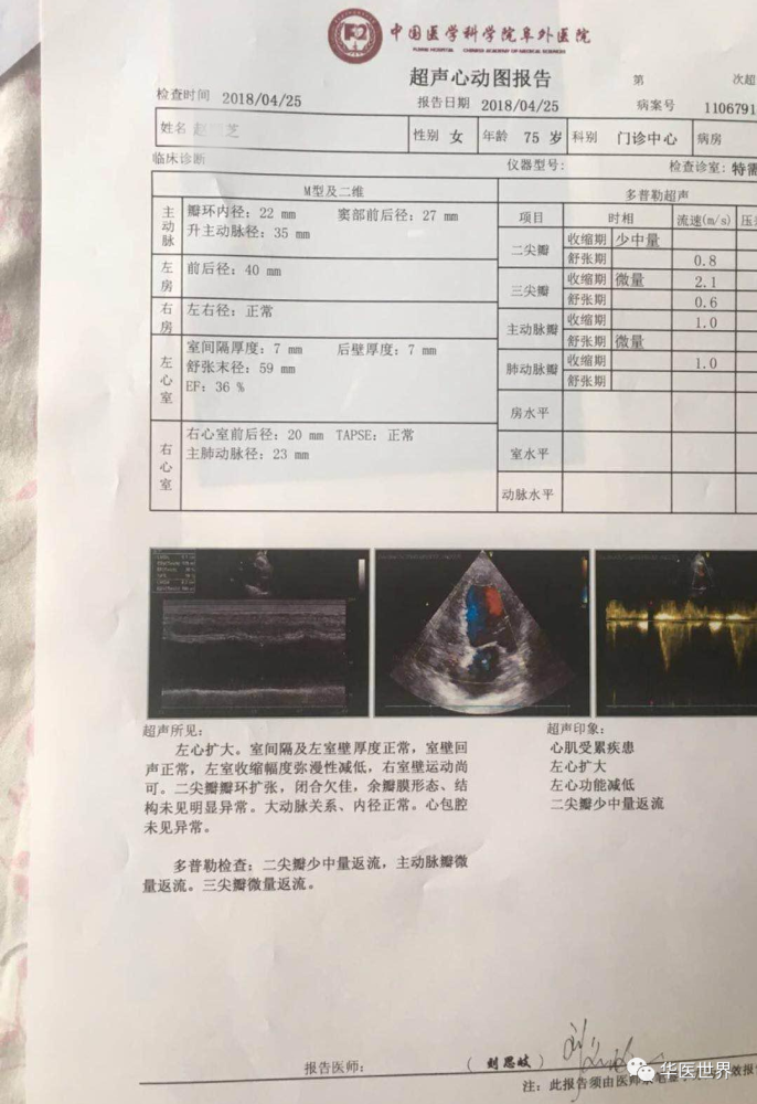 【最新教学视频】扩张型心肌病,王庆国教授用苓桂术甘汤治好了_腾讯