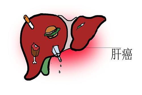 肝癌腹水的饮食注意事项
