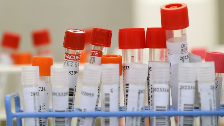 冠状病毒|冠状病毒：欧洲两名患者第二次感染COVID-19