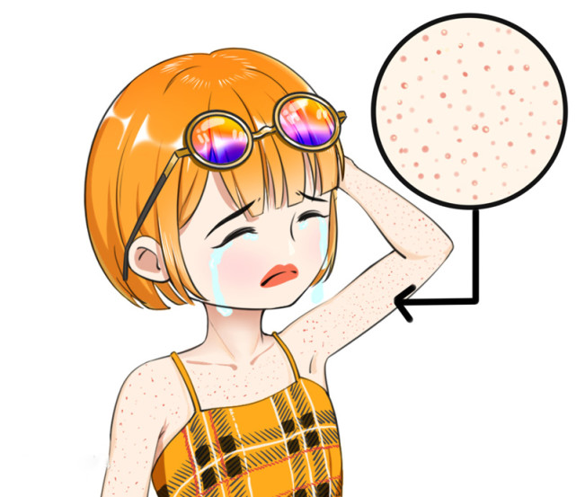 皮肤敏感鸡皮肤(鸡皮肤对什么过敏)