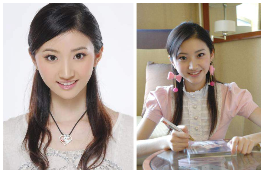 推骨近10次变精致小脸走红,堪称"被整形改变的命运"!