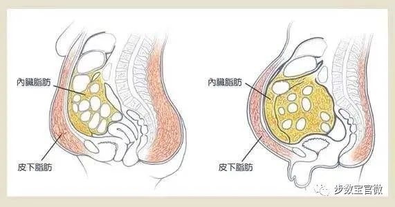 如何有效消除和抑制内脏脂肪的堆积