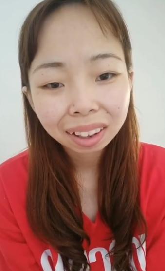 "快手嘟嘟姐"近况曝光!2年后"暴牙凸嘴"消失,网友吓歪:美炸