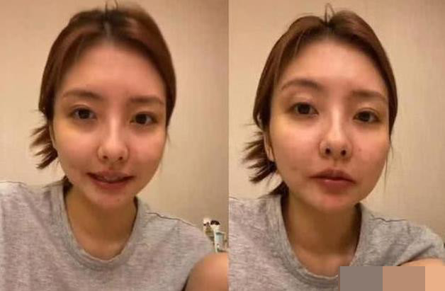 王思聪|王思聪前女友豆得晒素颜照，面部肿胀发福判若两人，苹果肌超夸张