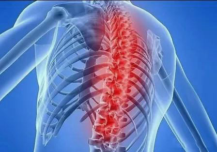 脊髓空洞症|北京专家于敏：脊髓空洞症最常见的症状有哪些？