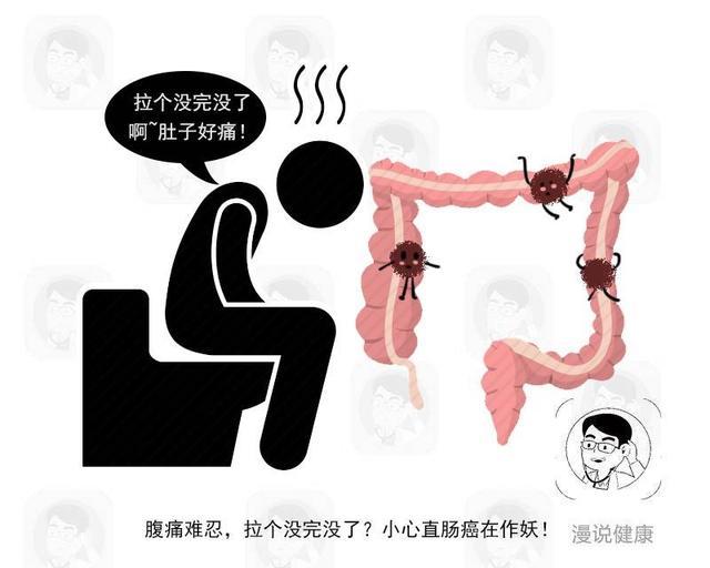 查德维克·博斯曼|黑豹演员因结肠癌去世：这4类人必须定期做肠镜，真不是图你钱！