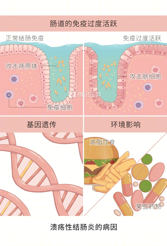 安倍晋三|被这种病折腾了近50年，日本首相安倍晋三最终选择辞职