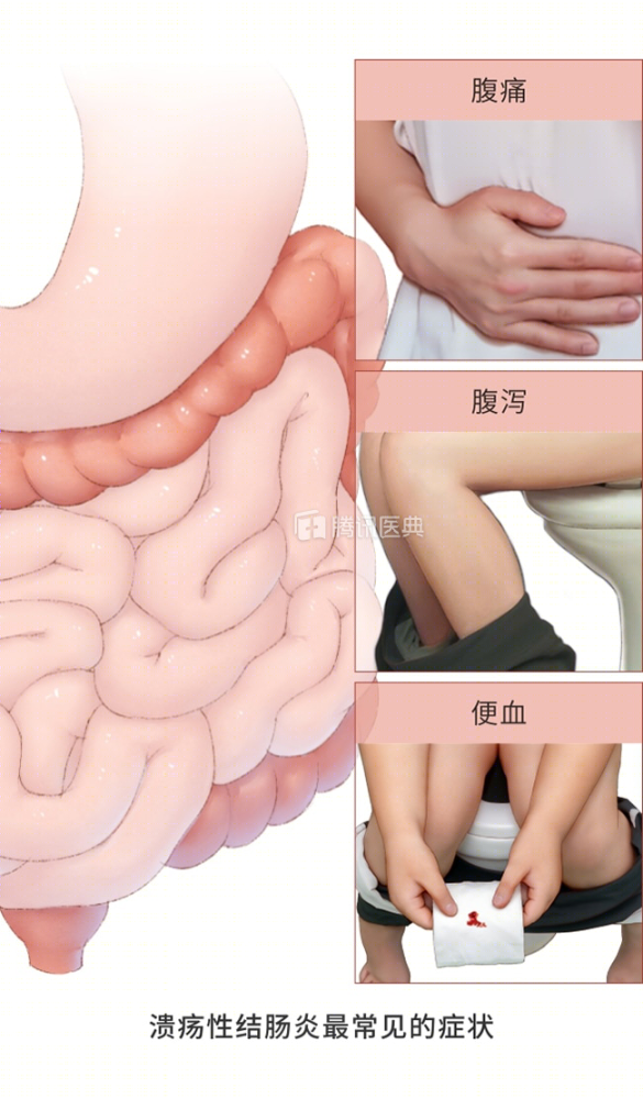 安倍晋三|被这种病折腾了近50年，日本首相安倍晋三最终选择辞职