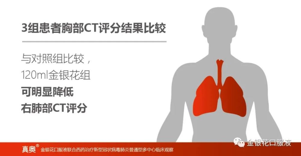 新型冠状病毒肺炎|《金银花口服液联合西药治疗新型冠状病毒肺炎普通型多中心临床观察》来啦！