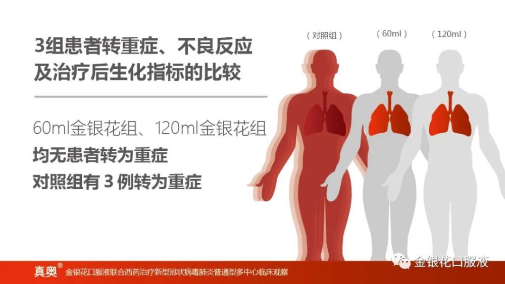 新型冠状病毒肺炎|《金银花口服液联合西药治疗新型冠状病毒肺炎普通型多中心临床观察》来啦！