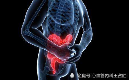 溃疡性结肠炎|击败安倍的是溃疡性结肠炎！病虽小众，但威力巨大，你听说过吗？