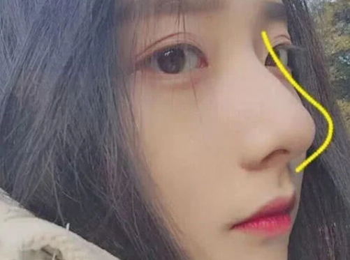 女生坚持做这3动作鼻子会越来越好看轻松逆袭校花脸