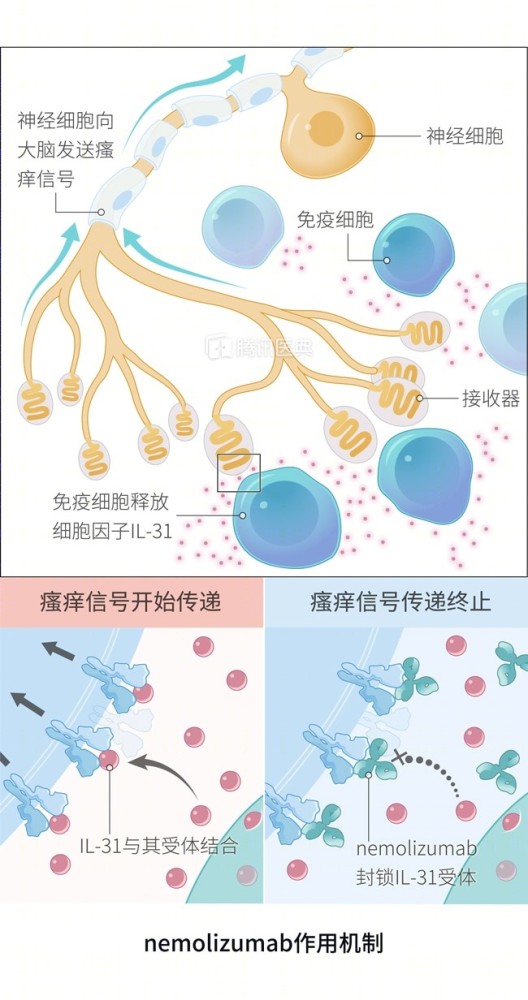 nemolizumab|痒，痒，痒？也许你需要它！