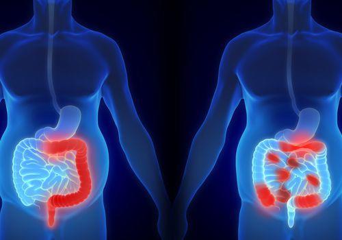 安倍晋三|让安倍抱憾辞职的痼疾，日本22万患者同病相怜：易反复，无法根治