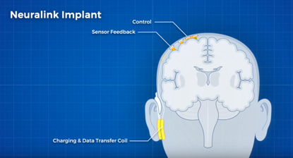 脑机接口|马斯克发布脑机接口：已无损植入猪脑，将在截瘫患者开展试验