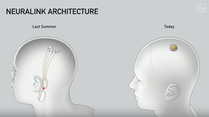 脑机接口|马斯克发布脑机接口：已无损植入猪脑，将在截瘫患者开展试验