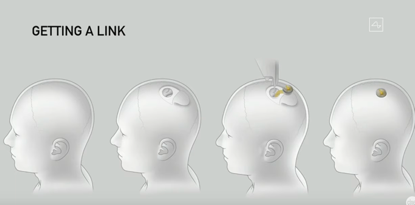 脑机接口|马斯克发布脑机接口：已无损植入猪脑，将在截瘫患者开展试验