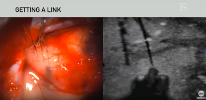 脑机接口|马斯克发布脑机接口：已无损植入猪脑，将在截瘫患者开展试验