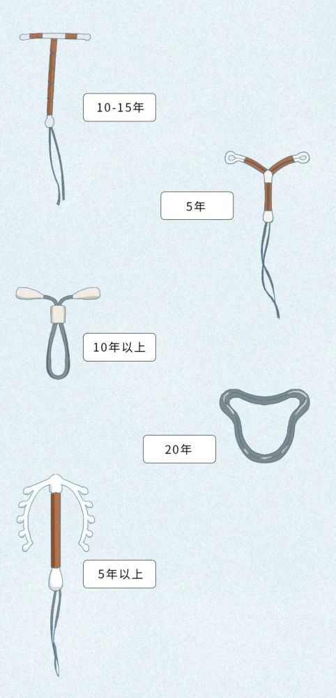 女性应该要了解并且能够自发自愿去选择的┆节育环