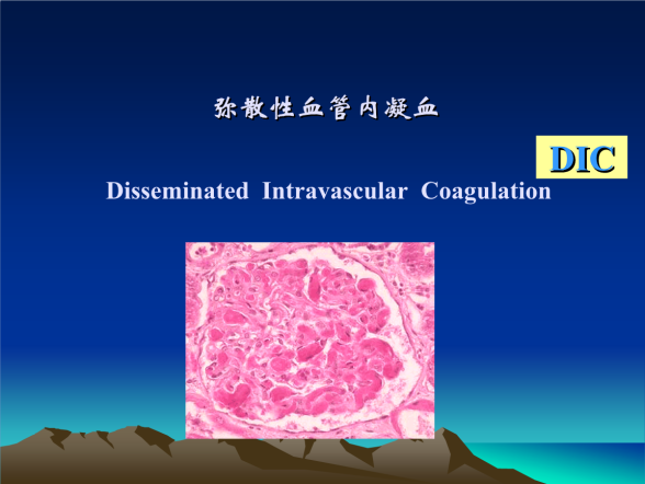 dic一定不要错过这些好方法
