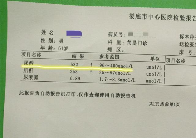 尿酸值530不高也不低除了吃药这方法降尿酸也很好