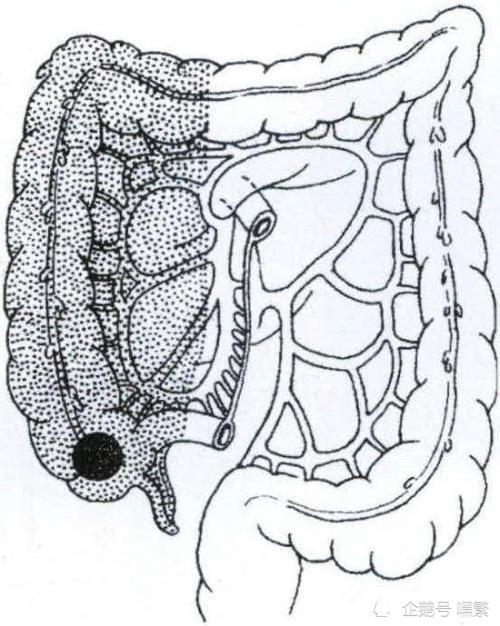 黑豹主演和安倍都是结肠生病如何关注自己的结直肠健康