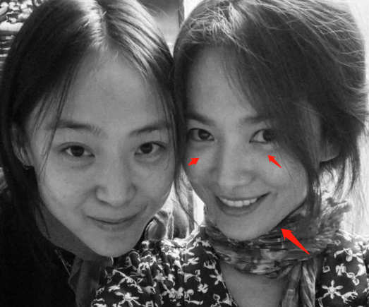 仍未走出离婚阴霾宋慧乔近照曝光太憔悴脸颊消瘦黑眼圈瞩目