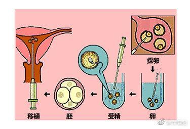 精子畸形率高都不活动还能做试管婴儿吗？插图