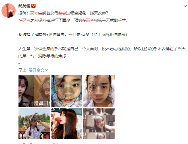 整容|00后高考完扎堆整容，中国的审美，什么时候沦落到靠整容脸来支撑了？