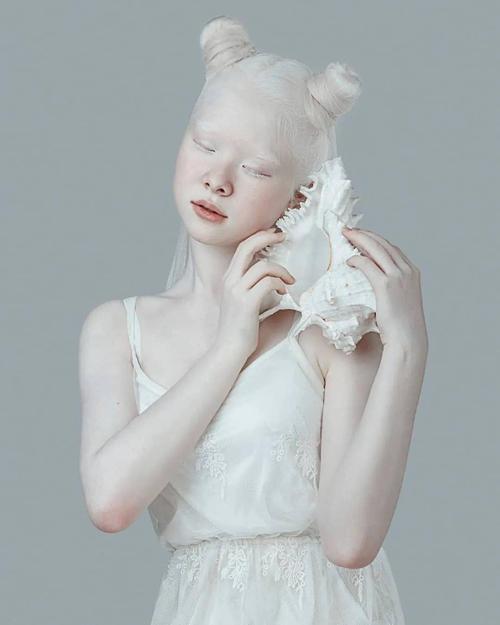 一对罕见的"白雪公主",被嘲讽14年,拍完一组照片后惊艳了世界