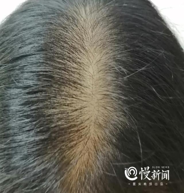 长期中分，发缝会变宽？_腾讯新闻