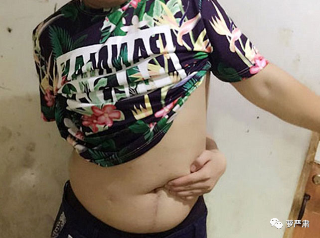李斯丹妮|高矮胖瘦都能被“身材羞辱”？这就是没道理！