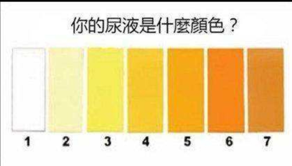 你的尿色正常吗?_腾讯新闻