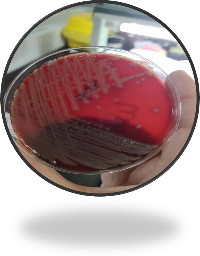 093) 2019.11.28 ▲血平板麦康凯平板培