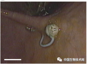 胶囊|“大榛子”团队又开发出新“玩意”：一种可吞咽的电子胶囊