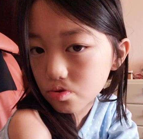 王菲14岁女儿和冯小刚30岁女儿同患兔唇简直就是天壤之别