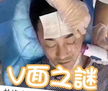 林峰|40岁林峰也做医美！拉皮画面被曝光，“冻龄男神”之谜疑被揭穿