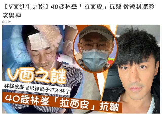 林峰|40岁林峰也做医美！拉皮画面被曝光，“冻龄男神”之谜疑被揭穿