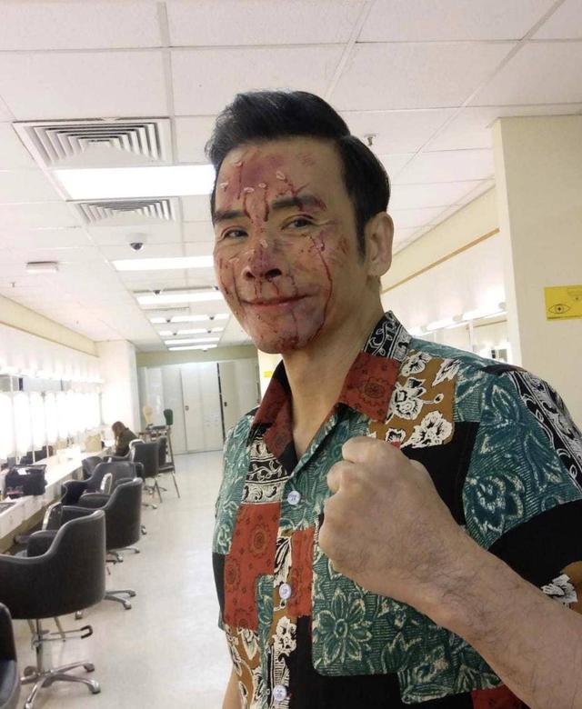 使徒行者猜fing一打十成经典自曝做割胆手术曾是名模