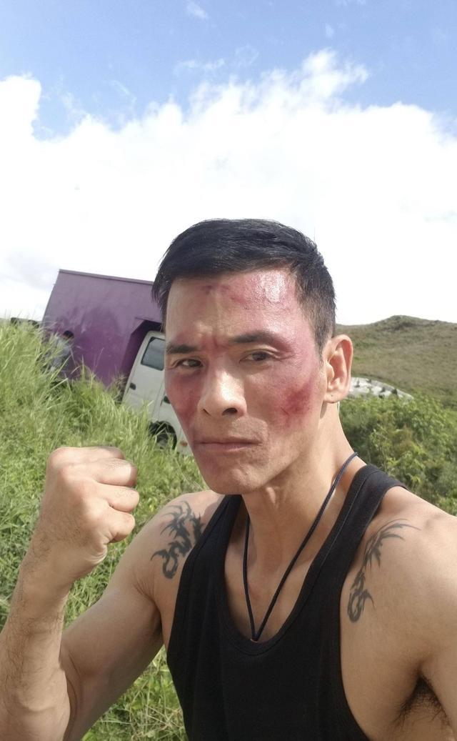 使徒行者猜fing一打十成经典自曝做割胆手术曾是名模