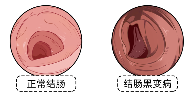 养生|深度揭秘：21世纪最大的养生骗局，天天都有人上当