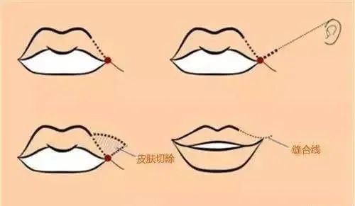 青3|《青3》用变性女孩炒热度，还有下限吗？