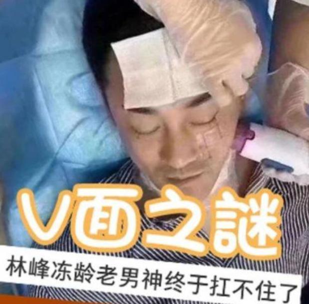 林峯被曝美容院做拉皮抗皱 脸型进化成v型 冻龄全靠美容保养 腾讯网