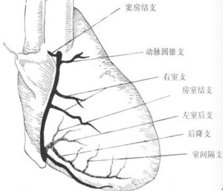 造影|冠状动脉造影真的有用么