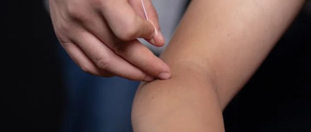 光学习了针灸,你知道针灸有哪些禁忌吗?