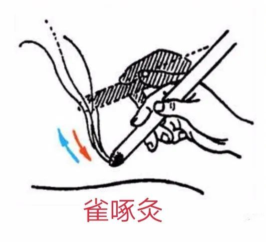 安军明教授谈穴位养生:宝宝老是尿床怎么办